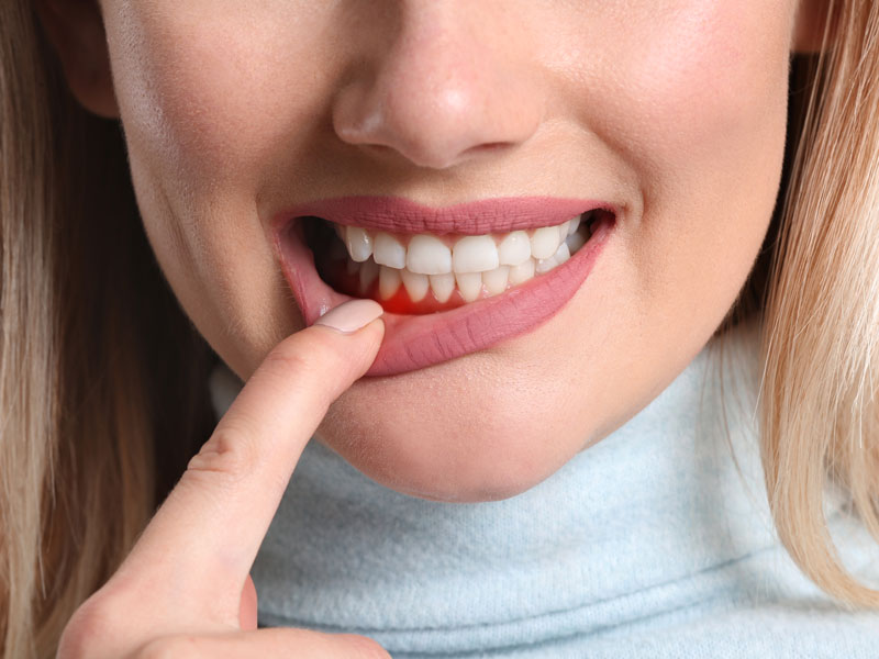 Patient with Braces